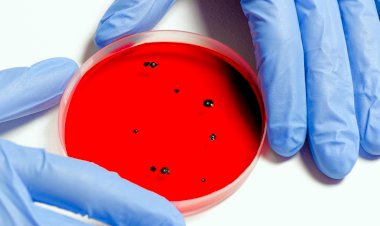 „Covid-19“ atvejų skaičius JAV viršija 4 milijonus