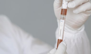 Izraelis atlieka „Covid-19“ kvėpavimo testą per 30 sekundžių